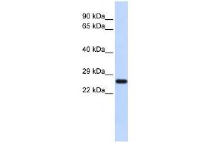 SOD2 antibody used at 1 ug/ml to detect target protein. (SOD2 anticorps  (N-Term))