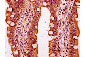 IHC image of ABIN7169980 diluted at 1:300 and staining in paraffin-embedded human small intestine tissue performed on a Leica BondTM system.