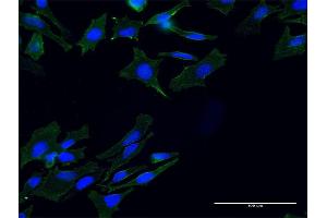 Immunofluorescence of monoclonal antibody to TLN1 on HeLa cell.