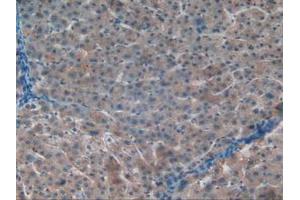 IHC-P analysis of Human Liver Tissue, with DAB staining. (APOC1 anticorps  (AA 31-83))