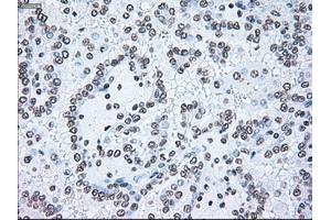 Image no. 18 for anti-B-Raf proto-oncogene, serine/threonine kinase (BRAF) antibody (ABIN1496961)