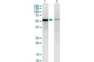 Western Blot analysis of GPI expression in transfected 293T cell line by GPI monoclonal antibody (M01), clone 8B8. (GPI anticorps  (AA 1-558))