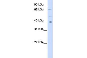 WB Suggested Anti-SPATA7 Antibody Titration: 0. (SPATA7 anticorps  (Middle Region))