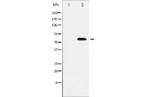 Western blot analysis of SOX9 expression in NIH-3T3 whole cell lysates,The lane on the left is treated with the antigen-specific peptide. (SOX9 anticorps)