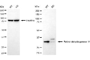 Western blotting analysis using retinol dehydrogenase 14 antibody (ABIN7800192). (RDH14 anticorps)