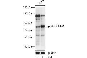 Western blot analysis of extracts of HeLa cells, using Phospho-EIF4B-S422 antibody (ABIN6135212, ABIN6136060, ABIN6136061 and ABIN6225673) at 1:2000 dilution. (EIF4B anticorps  (pSer422))