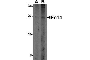 Western Blotting (WB) image for anti-Tumor Necrosis Factor Receptor Superfamily, Member 12A (TNFRSF12A) antibody (ABIN1031803) (TNFRSF12A anticorps)