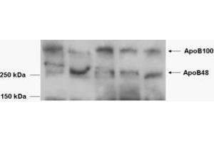 EB08792 (0. (APOB anticorps  (Internal Region))