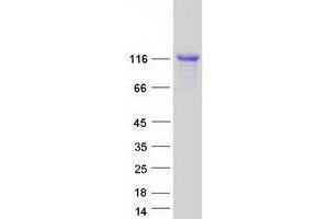 Validation with Western Blot