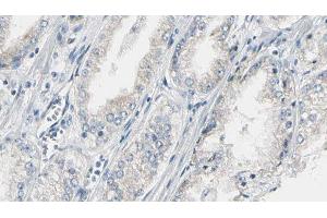 ABIN6274988 at 1/100 staining Human prostate tissue by IHC-P. (CEP170 anticorps  (Internal Region))