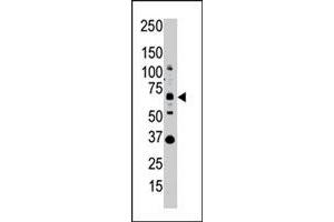 Western blot analysis of SENP1 polyclonal antibody  in whole HL-60 cell lysate : SENP1 (Arrow) was detected using purified polyclonal antibody. (SENP1 anticorps  (N-Term))