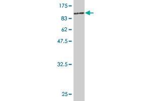 Western Blot detection against Immunogen (85. (Phosphoglucomutase 3 anticorps  (AA 1-542))