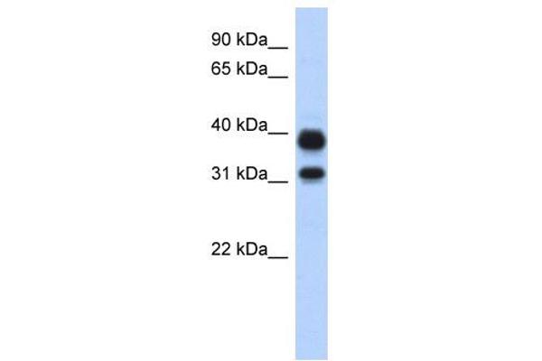 CHIA anticorps  (N-Term)
