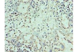 Immunohistochemistry of paraffin-embedded human prostate tissue using ABIN7173794 at dilution of 1:100 (TWEAK anticorps  (AA 42-123))