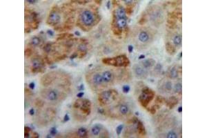 Used in DAB staining on fromalin fixed paraffin-embedded Liver tissue (ANXA6 anticorps  (AA 251-504))