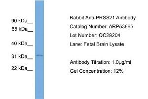 WB Suggested Anti-PRSS21  Antibody Titration: 0. (PRSS21 anticorps  (N-Term))
