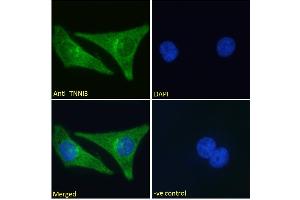 ABIN1590057 Immunofluorescence analysis of paraformaldehyde fixed HeLa cells, permeabilized with 0. (TNNI3 anticorps  (AA 117-127))