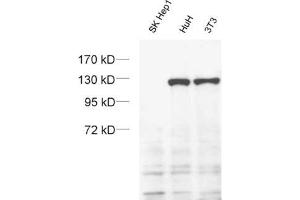 dilution: 1 : 1000 (ECL), sample: SK-Hep1 cell with a homozygous deletion of exportin 4. (XPO4 anticorps  (AA 927-1151))
