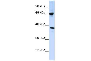 C6ORF134 antibody used at 1 ug/ml to detect target protein. (Chromosome 6 Open Reading Frame 134 (C6orf134) (Middle Region) anticorps)