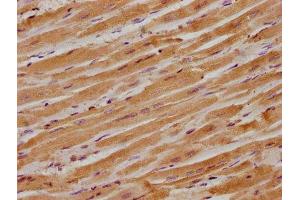 IHC image of ABIN7156473 diluted at 1:300 and staining in paraffin-embedded human heart tissue performed on a Leica BondTM system. (ITGB1BP1 anticorps  (AA 1-200))