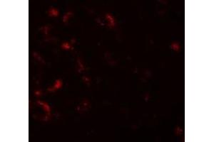 Immunofluorescencent staining of human brain cells with AXIN1 polyclonal antibody  at 20 ug/mL. (Axin anticorps  (C-Term))