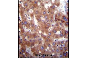 HSD17B4 Antibody (Center) (ABIN656447 and ABIN2845732) immunohistochemistry analysis in formalin fixed and paraffin embedded human liver tissue followed by peroxidase conjugation of the secondary antibody and DAB staining. (HSD17B4 anticorps  (AA 341-370))