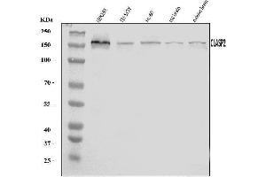 Western blot analysis of CLASP2 using anti-CLASP2 antibody (ABIN7600981).
