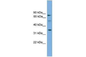 WB Suggested Anti-OSTalpha Antibody Titration: 0.