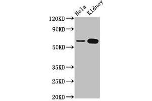 Western Blot Positive WB detected in: Hela whole cell lysate, Rat kidney tissue All lanes: TROVE2 antibody at 3.