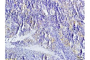 Formalin-fixed and paraffin-embedded: rat spleen tissue labeled with Rabbit Anti-TNFSF14 Polyclonal Antibody, Unconjugated (ABIN740625) 1:200 followed by conjugation to the secondary antibody and DAB staining (TNFSF14 anticorps  (AA 141-240))