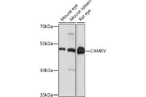 Western blot analysis of extracts of various cell lines, using CAMKV Rabbit pAb (ABIN7266051) at 1:1000 dilution. (CAMKV anticorps  (AA 1-285))