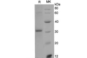 Western Blotting (WB) image for Adiponectin (ADIPOQ) (Active) protein (His tag) (ABIN7320936) (ADIPOQ Protein (His tag))