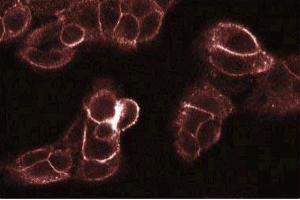 Immunofluorescence staining of A431 cells. (PKC theta anticorps  (AA 21-217))