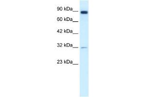 WB Suggested Anti-MMP9 Antibody Titration:  1. (MMP 9 anticorps  (N-Term))