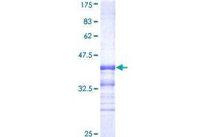 Image no. 1 for Cyclin-Dependent Kinase 8 (CDK8) (AA 375-464) protein (GST tag) (ABIN1348983)