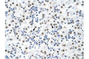 MSI2 antibody was used for immunohistochemistry at a concentration of 4-8 ug/ml to stain Hepatocytes (arrows) in Human Liver. (MSI2 anticorps)