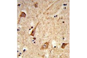 Immunohistochemistry analysis in formalin-fixed and paraffin-embedded human brain tissue reacted with GALNT2 Antibody (N-term) followed which was peroxidase-conjugated to the secondary antibody, followed by DAB staining. (GALNT2 anticorps  (N-Term))