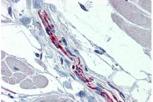 Human Heart, Nerve (formalin-fixed, paraffin-embedded) stained with TH antibody ABIN364267 at 1:100 followed by biotinylated goat anti-rabbit IgG secondary antibody ABIN481713, alkaline phosphatase-streptavidin and chromogen. (Tyrosine Hydroxylase anticorps)