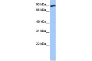 Western Blotting (WB) image for anti-WD Repeat and FYVE Domain Containing 3 (WDFY3) antibody (ABIN2463379)
