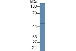 Detection of RIPK2 in Rat Placenta lysate using Polyclonal Antibody to Receptor Interacting Serine Threonine Kinase 2 (RIPK2) (RIPK2 anticorps  (AA 1-294))