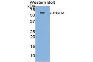 Western Blotting (WB) image for anti-CUB and Zona Pellucida-Like Domains 1 (CUZD1) (AA 218-479) antibody (ABIN1858570)