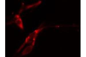 ABIN6274364 staining COLO205 cells by IF/ICC. (ANKRD1 anticorps  (Internal Region))