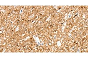 Immunohistochemistry of paraffin-embedded Human brain using AMZ1 Polyclonal Antibody at dilution of 1:80
