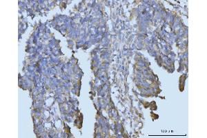 IHC analysis of BCKDK using anti-BCKDK antibody (ABIN7601470). (BCKDK anticorps  (AA 36-316))