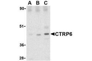 Western blot analysis of CTRP6 in mouse brain cell lysate with AP30257PU-N CTRP6 antibody at (A) 0.