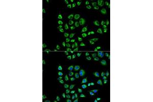 anti-CD1d Molecule (CD1D) (AA 20-190) antibody