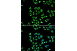 Immunofluorescence analysis of HeLa cells using CD1D antibody (ABIN3022497, ABIN3022498, ABIN3022499 and ABIN6218859). (CD1d anticorps  (AA 20-190))