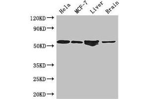 Western Blot Positive WB detected in: Hela whole cell lysate, MCF-7 whole cell lysate, Mouse liver tissue, Mouse brain tissue All lanes: ETS2 antibody at 2. (ETS2 anticorps  (AA 9-185))