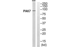 Western Blotting (WB) image for anti-P21 Protein (Cdc42/Rac)-Activated Kinase 7 (PAK7) (C-Term) antibody (ABIN1852718) (PAK7 anticorps  (C-Term))