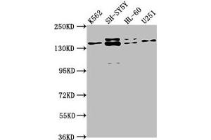 Western Blot Positive WB detected in: K562 whole cell lysate, SH-SY5Y whole cell lysate, HL-60 whole cell lysate, U251 whole cell lysate All lanes: AHI1 antibody at 1:2000 Secondary Goat polyclonal to rabbit IgG at 1/50000 dilution Predicted band size: 138, 121, 71 kDa Observed band size: 138 kDa (AHI1 anticorps  (AA 1-213))